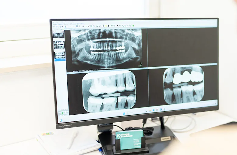 Foto maken om te bepalen of vullingen nodig zijn Foto maken om te bepalen of vullingen nodig zijn